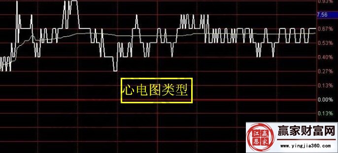 心電圖類(lèi)型走勢(shì)圖
